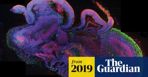 Scientists 'may have crossed ethical line' in growing human brains