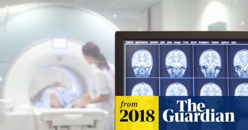 London hospitals to replace doctors and nurses with AI for some tasks