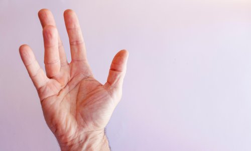 Treatment for finger-bending disease may be ‘gamechanger’