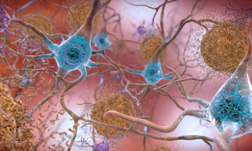 FDA advisers say new Alzheimer’s drug lecanemab slows cognitive decline