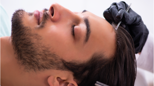 CHOOSE RIGHT NON-SURGICAL HAIR SYSTEM FOR MEN