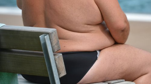 Adipositas: Wie sich Übergewicht bis 2035 weltweit verbreiten soll