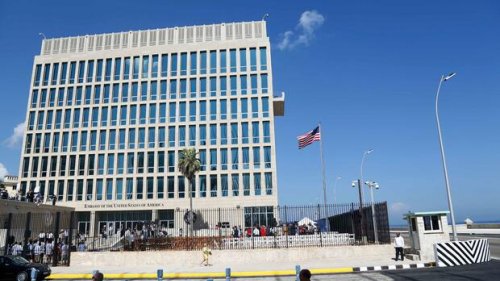 USA Ärzte erklären Havanna-Syndrom bei US-Diplomaten mit gewöhnlichen Ursachen