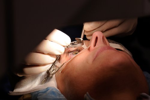 LASIK Surgery: What to expect - Harvard Health