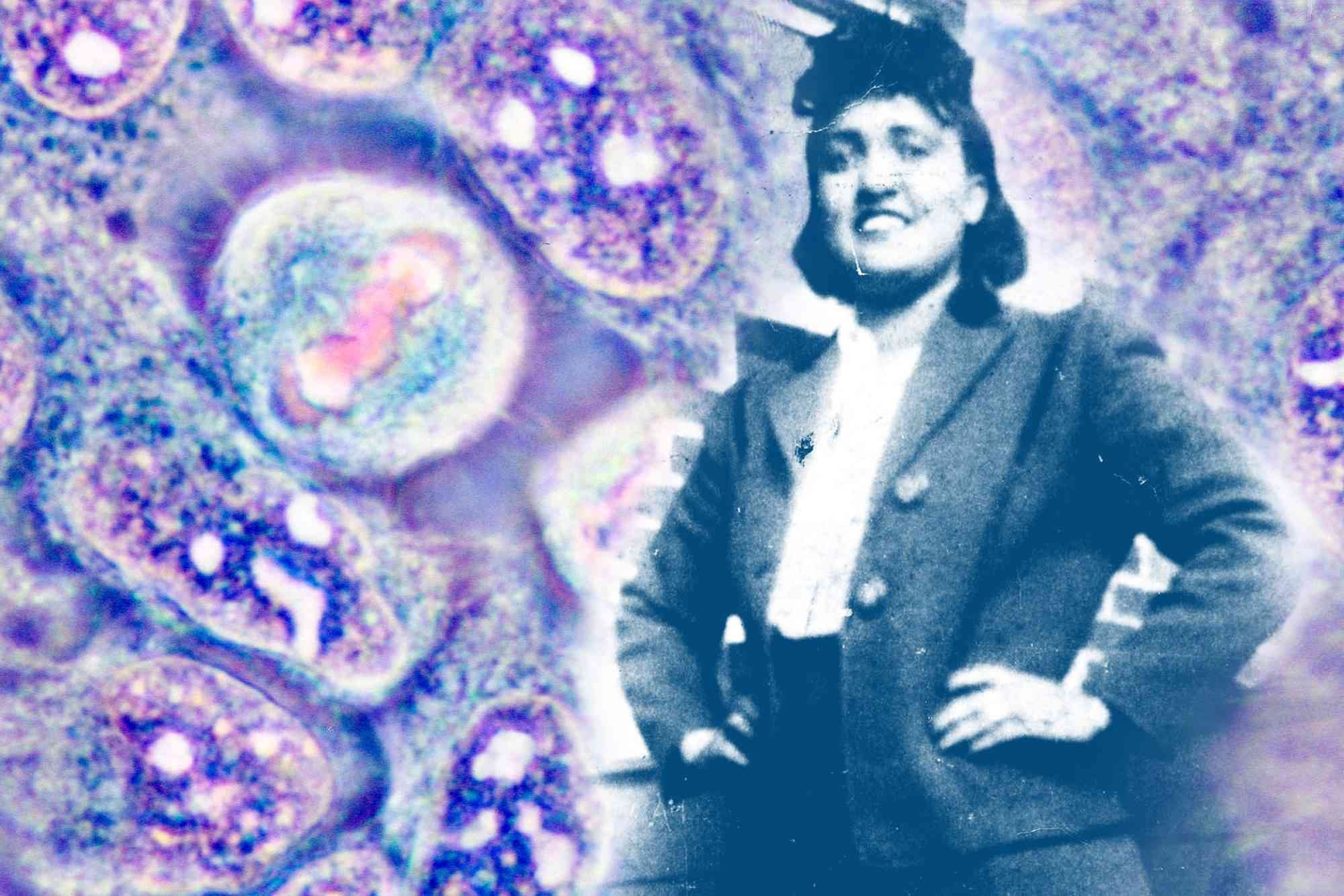 Henrietta Lacks' 'Immortal' Cells: Medical Marvel, Ethical Morass
