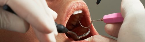 10 Surprising Facts About Dental Health & 10 Ways To Keep Your Teeth Clean