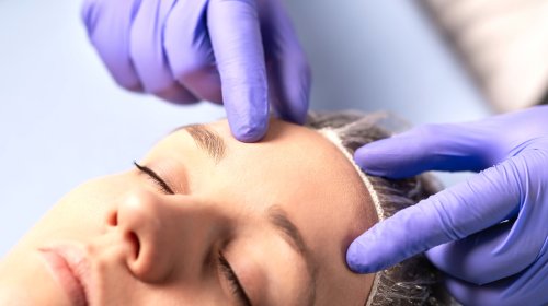 What To Know About Forehead Reduction Surgery