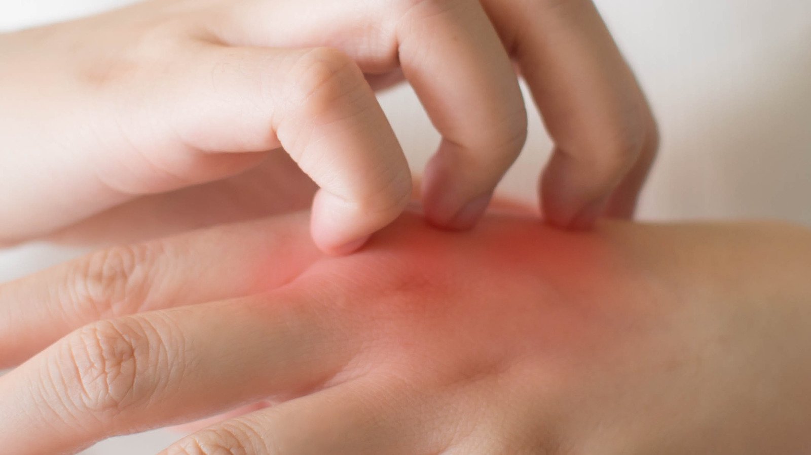 What Contact Dermatitis On Your Skin Really Means
