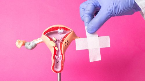 Cervical Stump Cancer: Symptoms, Diagnosis, And Treatment