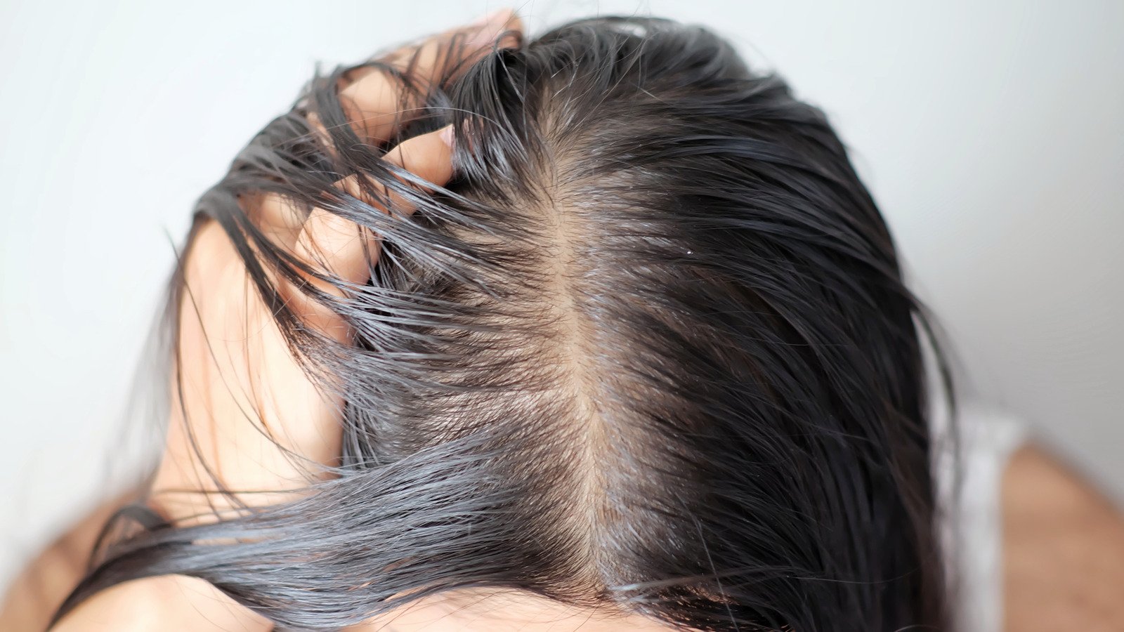 What It Really Means When Your Hair Starts Thinning