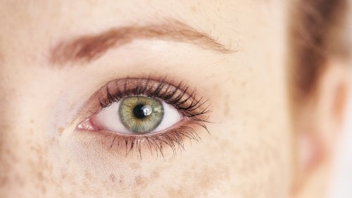 What Green Eyes Can Predict About Your Health