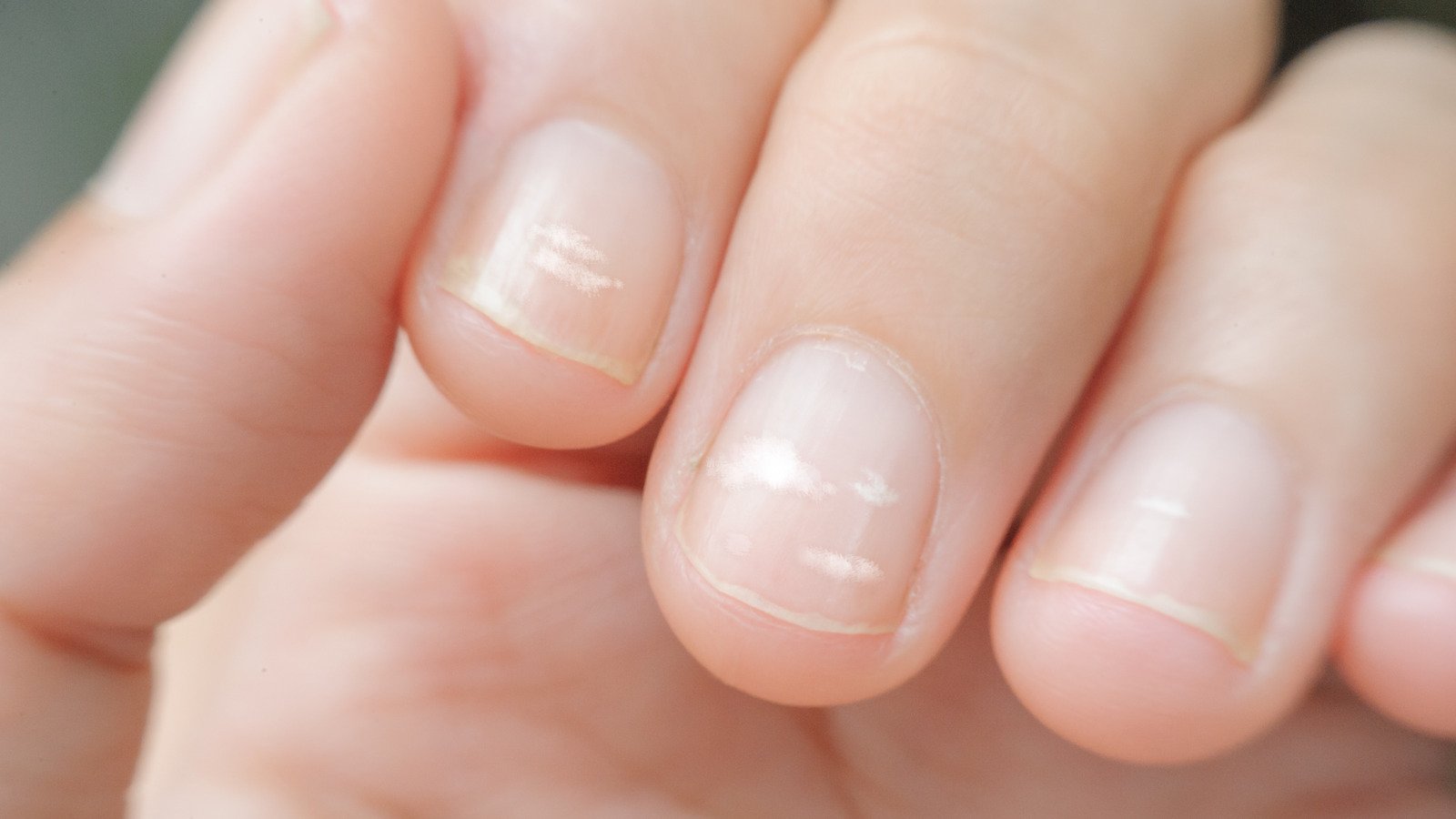 What Those White Spots On Your Fingernails Really Mean - Health Digest