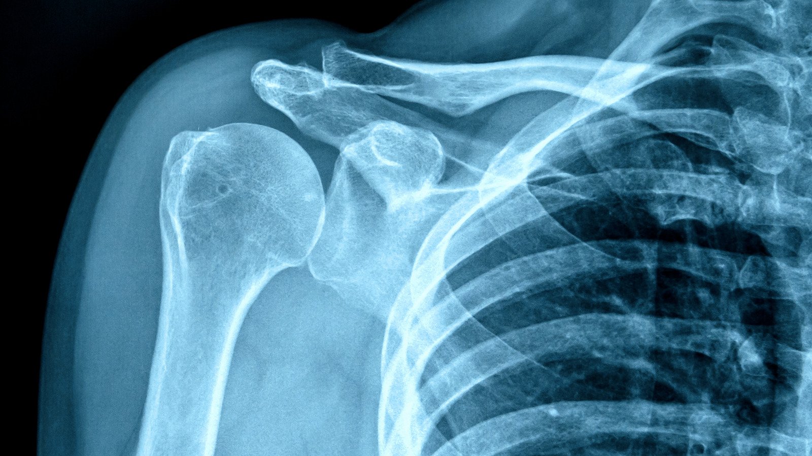 What Getting An X-Ray Really Does To Your Body
