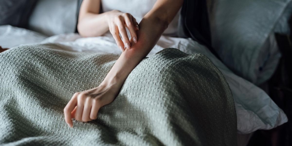 How Eczema Affects Sexual Health