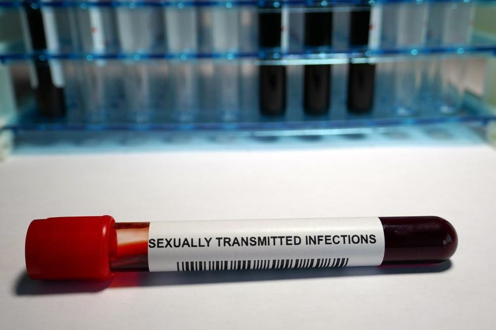 You Can Test Yourself for an STI at Home — but Should You?