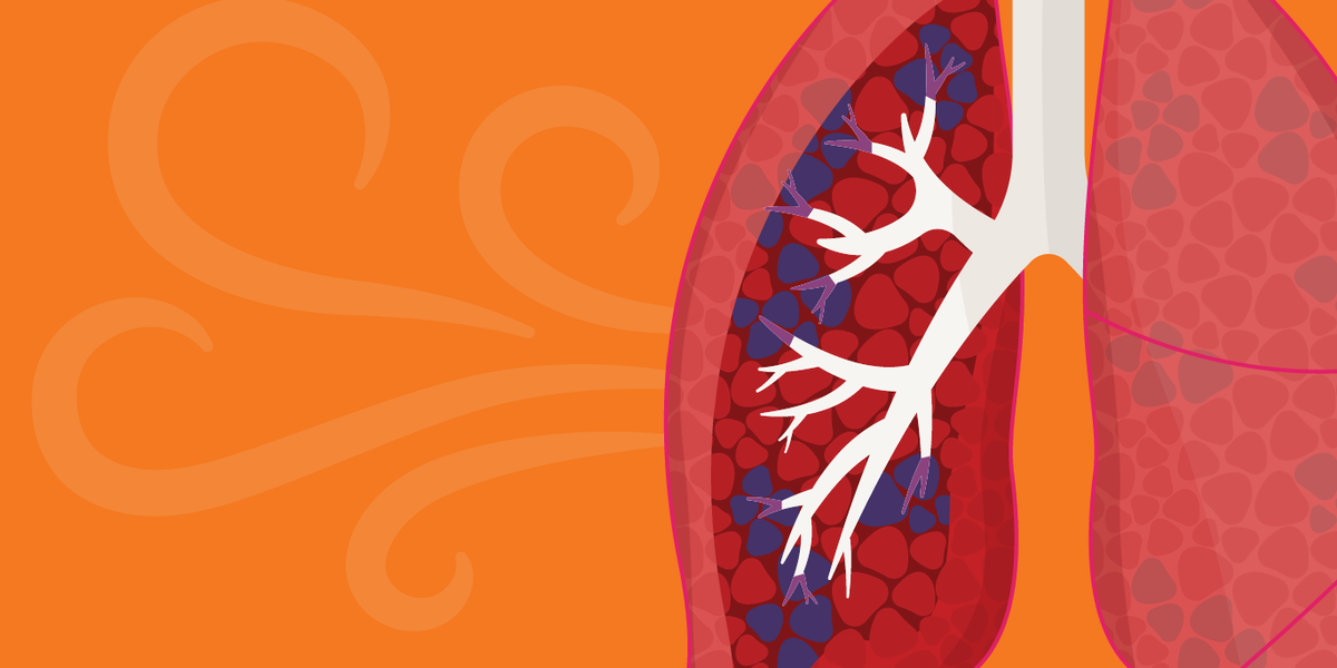 COPD Treatments