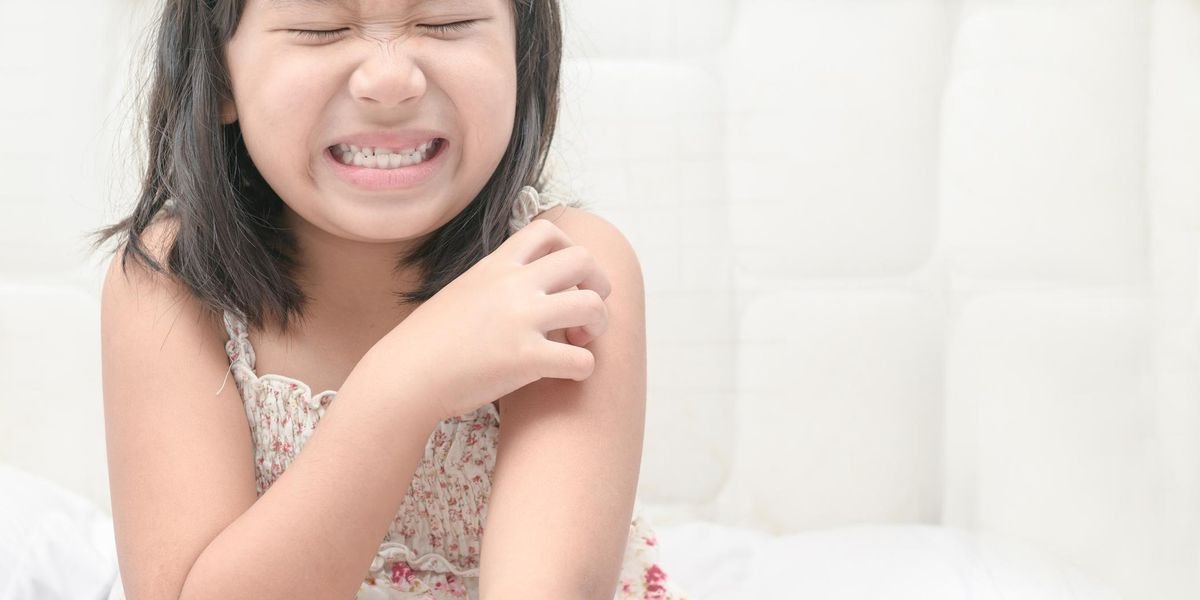 Eczema and Children: What Parents Can Do to Keep Their Kids Healthy