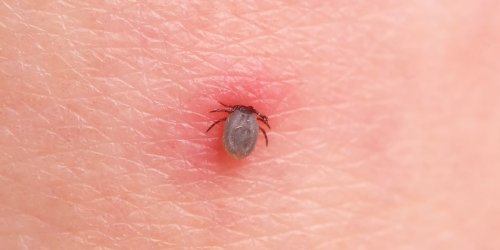 The Best Way to Treat a Tick Bite, According to Dermatologists