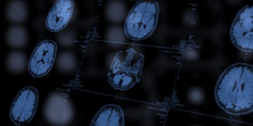 A Single Cubic Millimeter of Brain Tissue May Have Just Changed Neuroscience Forever