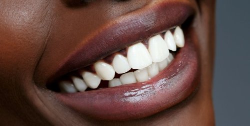 The 10 Best Teeth Whitening Pens to Brighten Your Smile Anytime, Anywhere