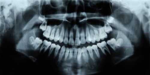 Humans Have a Third Set of Teeth. New Medicine May Help Them Grow