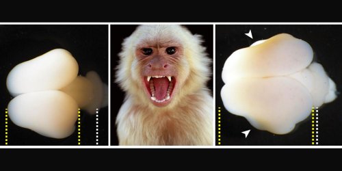 Uh-Oh, Scientists Used Human Genes to Make Monkey Brains Bigger