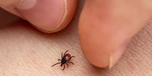 How to Remove a Tick Head—the Right Way