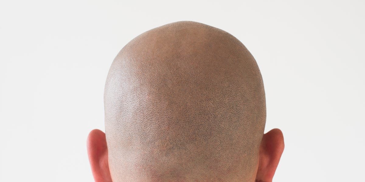 Scientists Discovered the Cure for Balding—And It’s Hiding Beneath Your Feet