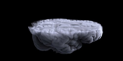 Human Brains Have Gotten Astonishingly Bigger Over the Last 75 Years