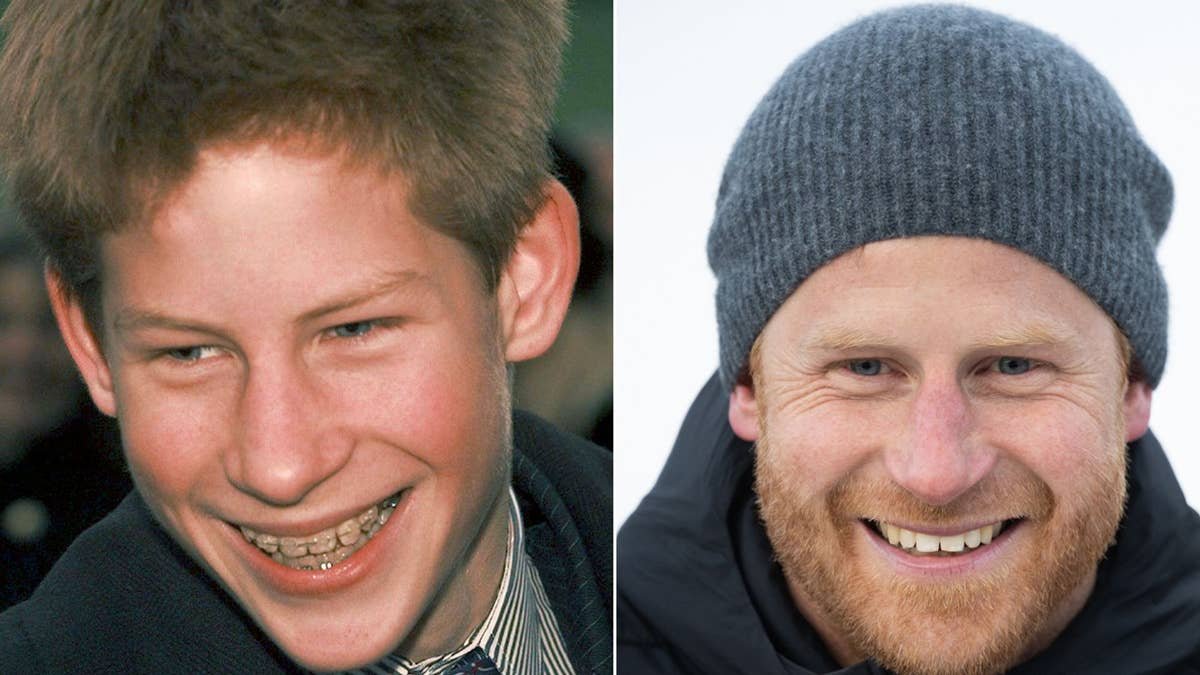 Queen Elizabeth II to Prince Harry: British royal teeth transformations seen in drastic before-and-after pictures