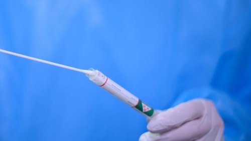 Corona in Deutschland: Aktuelle RKI-Fallzahlen, Inzidenz, Hospitalisierungsrate