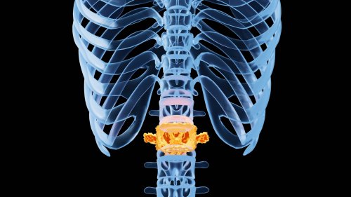 Revolutionizing Spine Care: How Patents Propel Advances