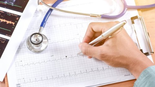 Langzeit-EKG: Gründe, Ablauf, Dauer und Auswertung