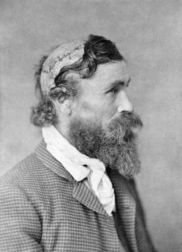 Robert McGee: The Man Who Was Scalped and Survived