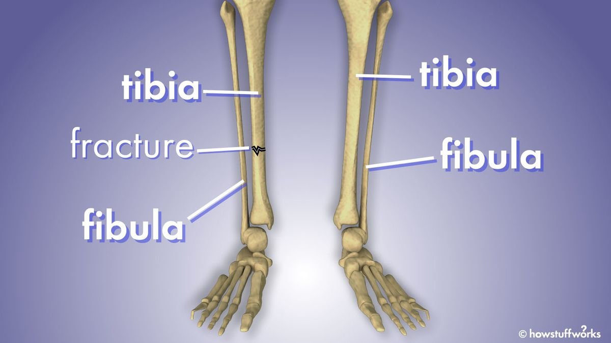 What's the Difference Between the Fibula and Tibia?