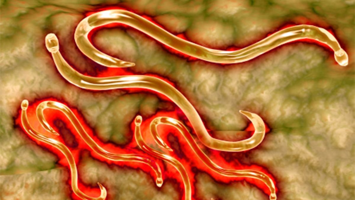 4 Signs You're Infected With a Parasite