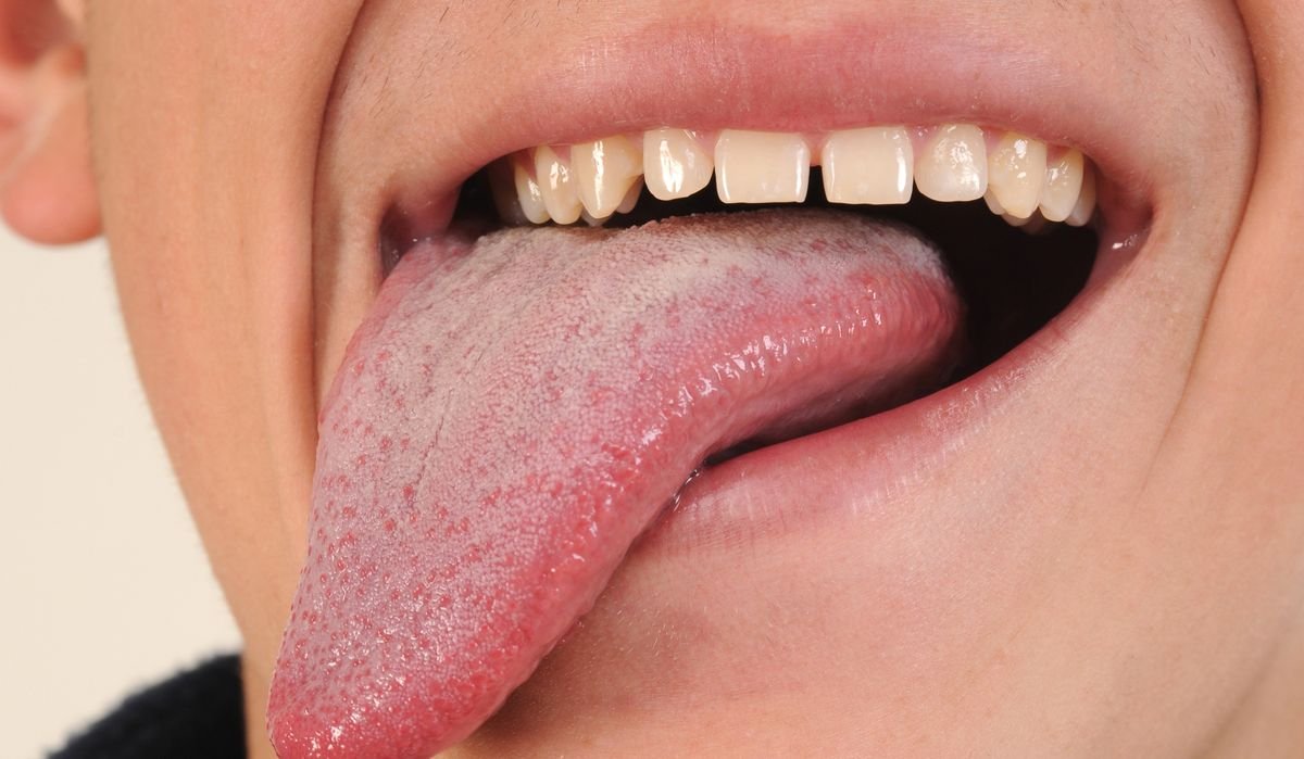 Is It Possible To Swallow Your Tongue?