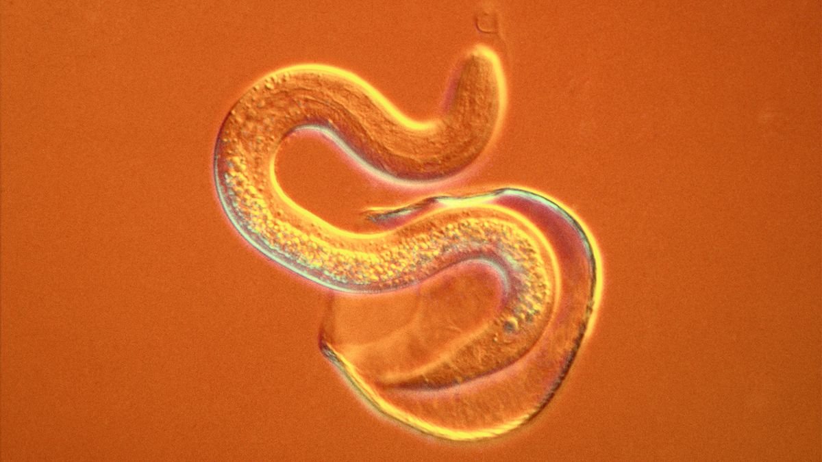 Nematodes: Do We Still Need to Worry About Roundworms and Bare Feet?