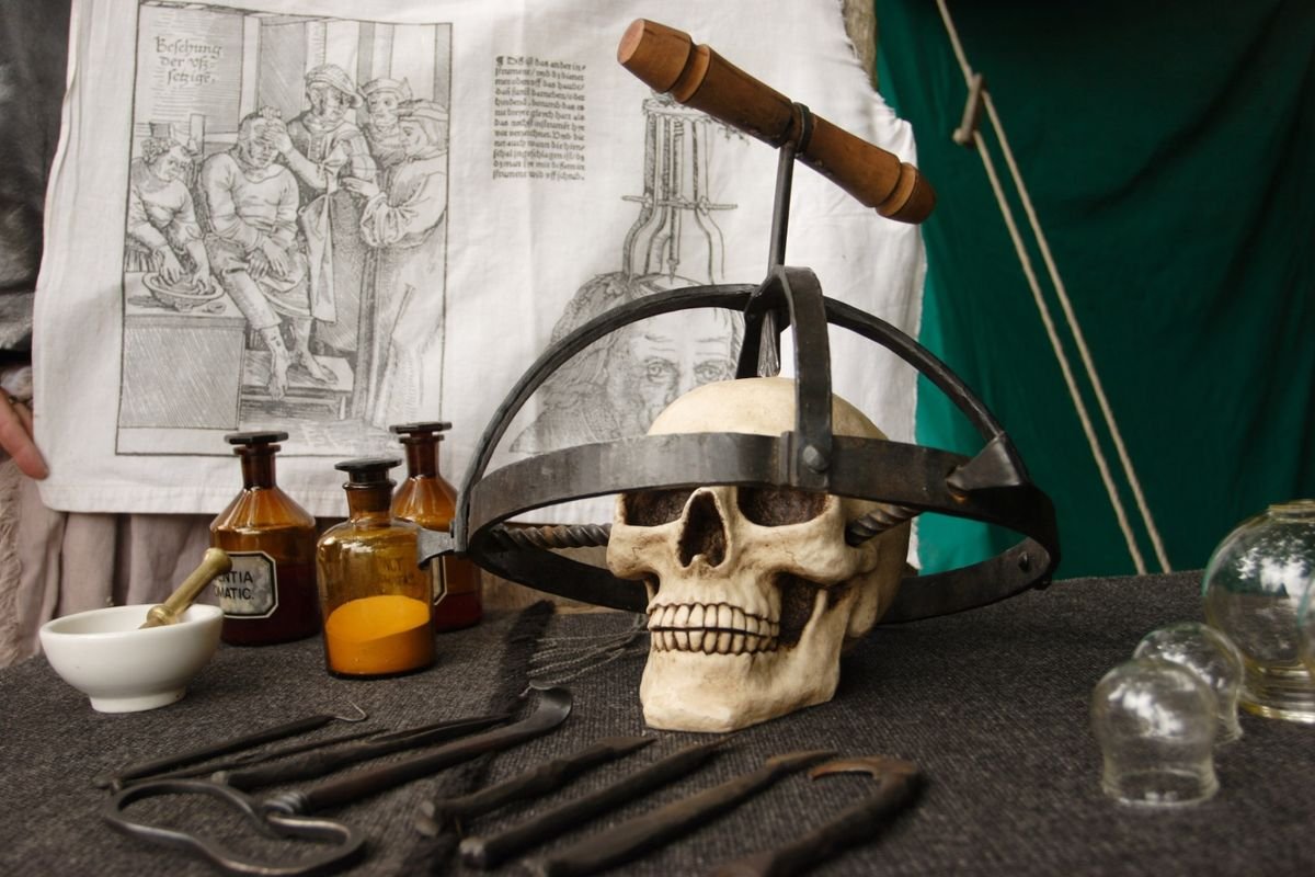 You Need It Like a Hole in the Head: The Ancient Medical Art of Trepanation
