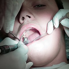 Braces, an essential element of modern dental care