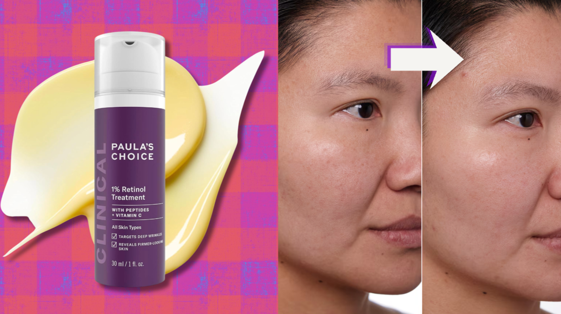This Retinol Has ‘Pesky Wrinkles Backing Off Like They Just Got Yelled At’ — And It’s 25% Off