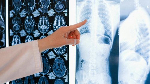 Une IRM peut prédire les crises cardiaques jusqu’à 10 ans avant qu’elles surviennent, selon cette étude