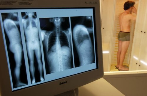 Bientôt un gel révolutionnaire contre l’arthrose du genou développé par des scientifiques français ?