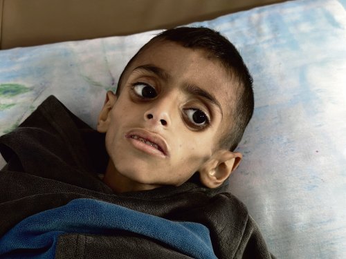 « Depuis 72 jours, pas un seul morceau de pain n’est entré » : à Gaza, « une famine délibérée et entièrement fabriquée » par Israël