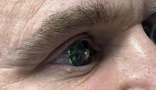 Mojo Vision Puts Its AR Contact Lens Into Its CEO’s Eyes (Literally)