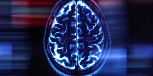 “Brain Age” AI Discovers Early Alzheimer’s Signs