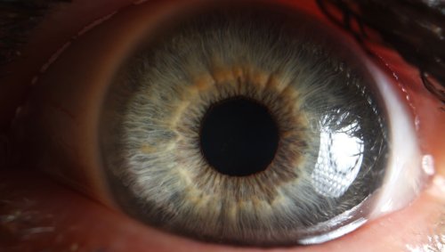 Even Mild COVID-19 Infections Can Cause Long-Term Eye Problems. But Diagnosis May Finally Be Possible