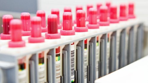 38 Neuinfektionen in Iserlohn