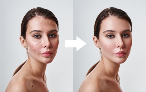 From Simple to High-End Skin Retouching in Photoshop!