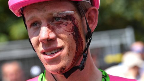 After '3 Weeks of Pain,' an American With a Broken Shoulder Finished Last in the Tour de France. Why He Kept Riding Is Truly Inspiring